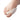Varisan Large Bunion Hydrogel Protector